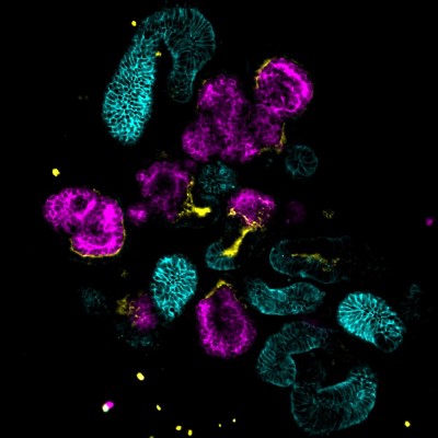 Microscope image of genetically engineered kidney organoids that were used to solve a medical mystery about tuberous sclerosis complex. Image Credit: Cell Reports